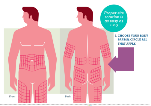 Graphic showing the front and back of a body with injection sites shown in grided areas on abdomen, arms, belly, glutes, and legs.